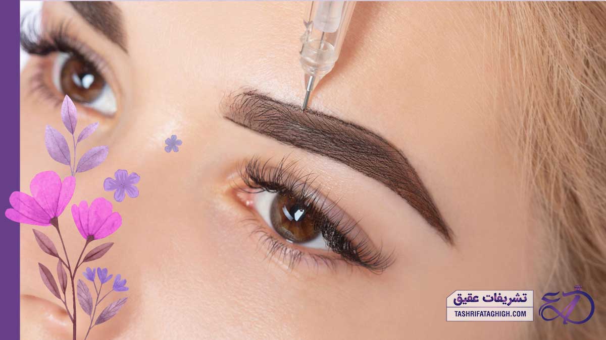 10 بهترین مرکز فیبروز ابرو در کرج