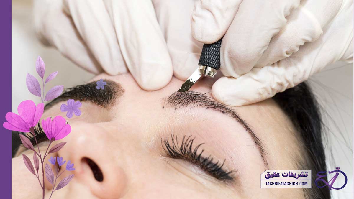 10 بهترین مرکز فیبروز ابرو در کرج