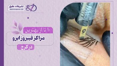 10 بهترین مرکز فیبروز ابرو در کرج