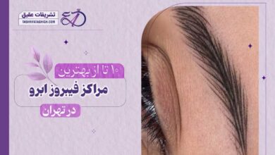 10 بهترین مرکز فیبروز ابرو در تهران