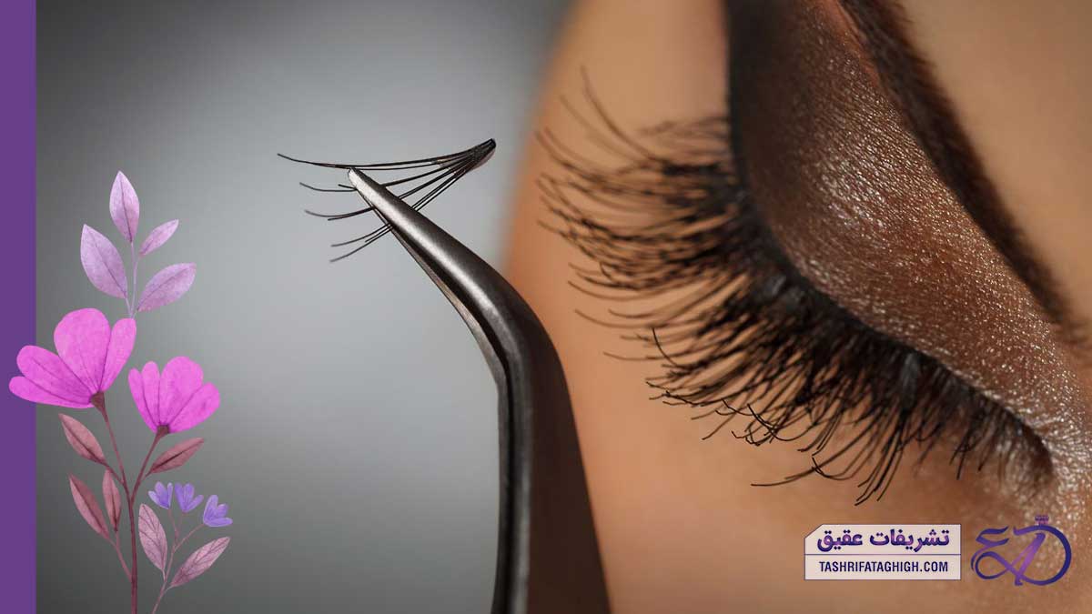 10 بهترین مرکز کاشت و اکستنشن مژه در شمال تهران