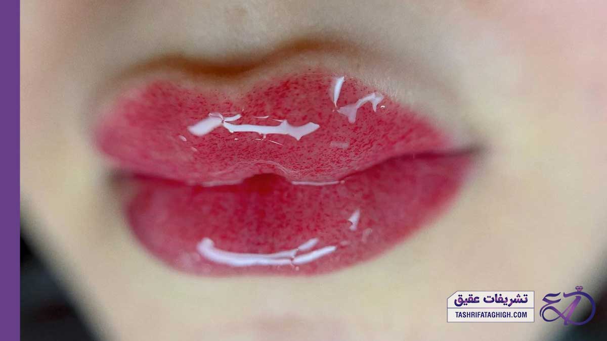 10 بهترین مرکز شیدینگ لب در تهران