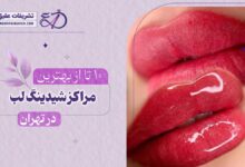 10 بهترین مرکز شیدینگ لب در تهران