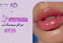 10 بهترین مرکز شیدینگ لب در کرج